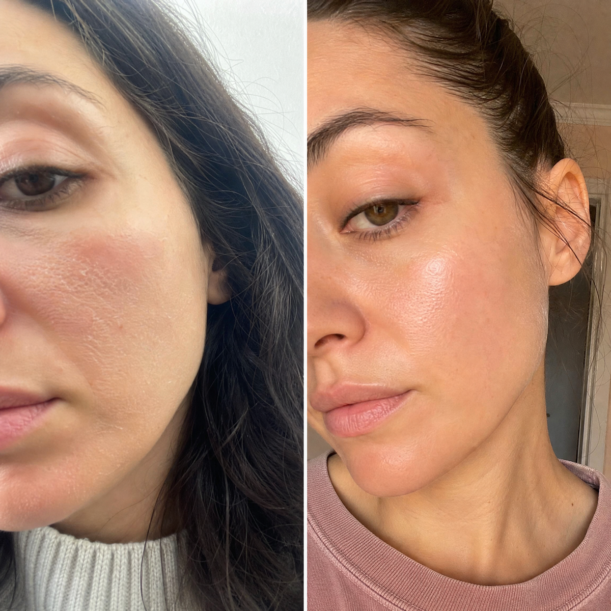 Set HYDRA + Gua Sha din cuarț roz