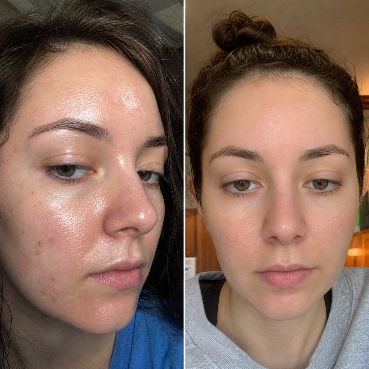 Set PURE AM + Gua Sha din cuarț roz