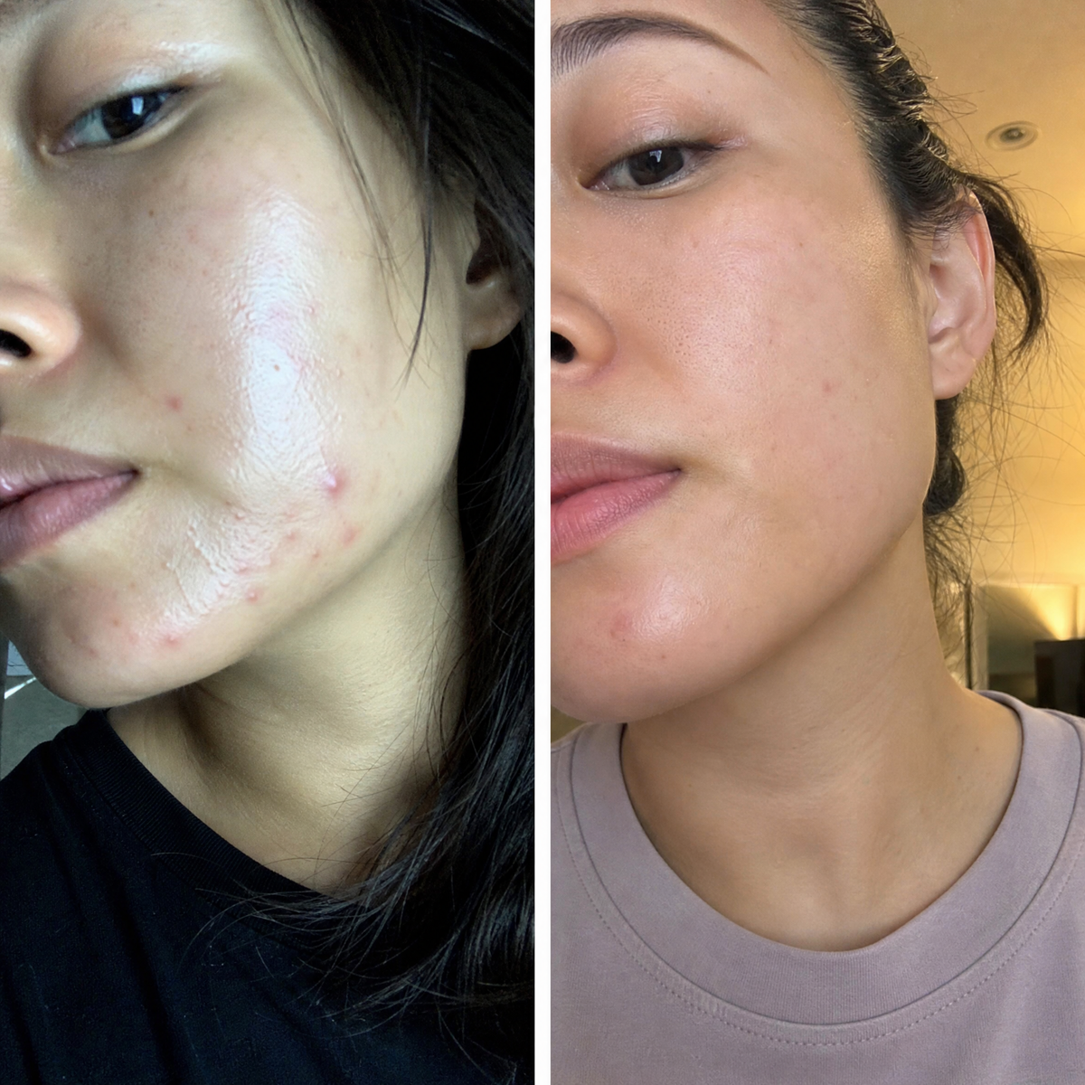 Set PURE PM + Gua Sha din cuarț roz