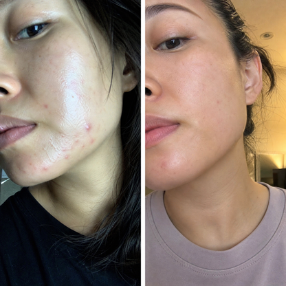 Set PURE PM + Gua Sha din cuarț roz