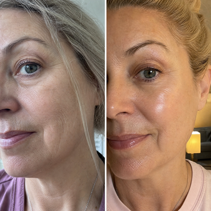 Set RENEW + Gua Sha din cuarț roz